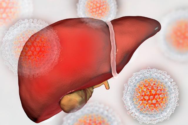 肝炎治疗最新进展，前沿科技与医学突破的探索